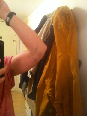 What a lovely bruise I've got.